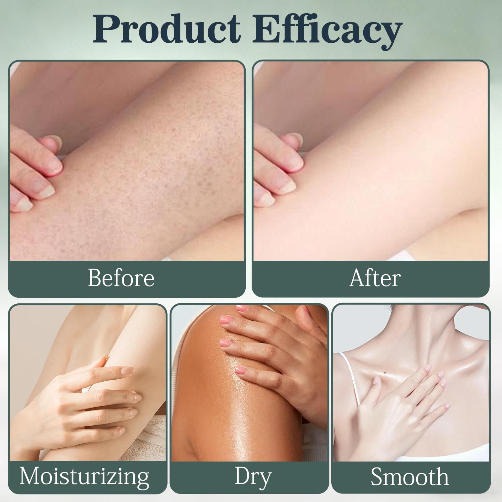 XiuFa 2PCS Intertrigo Cream – Skin Fold Care, Chafing Support, Fast-Drying Non-Greasy Formula