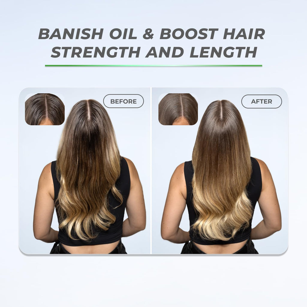 XMONDO Hair BOOST X Dry Shampoo – Saw Palmetto for Scalp Care, Talc-Free, Dermatologist Tested, 5 oz
