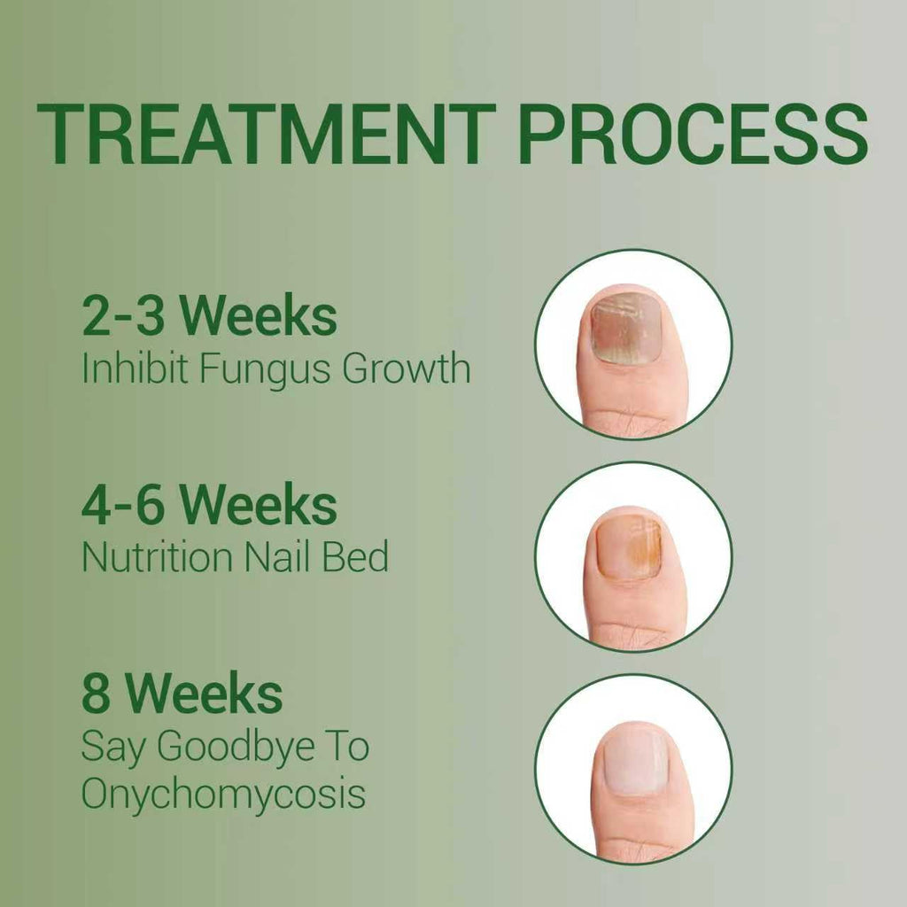 Xvywalo Nail Fungus Treatment Gel - Nail Growth Serum for Repair (2 pcs)