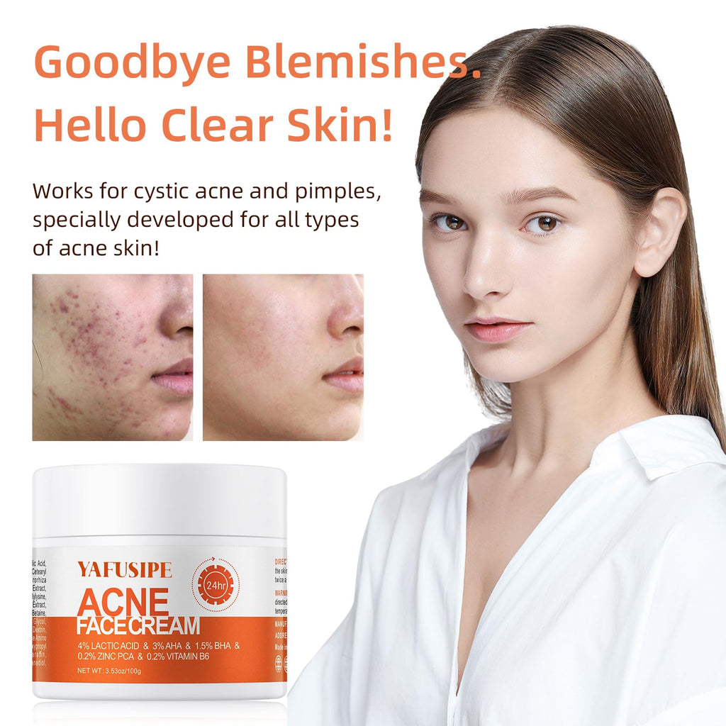YAFUSIPE Acne Treatment Cream for Cystic Breakouts – Gentle, All-Skin-Types Formula