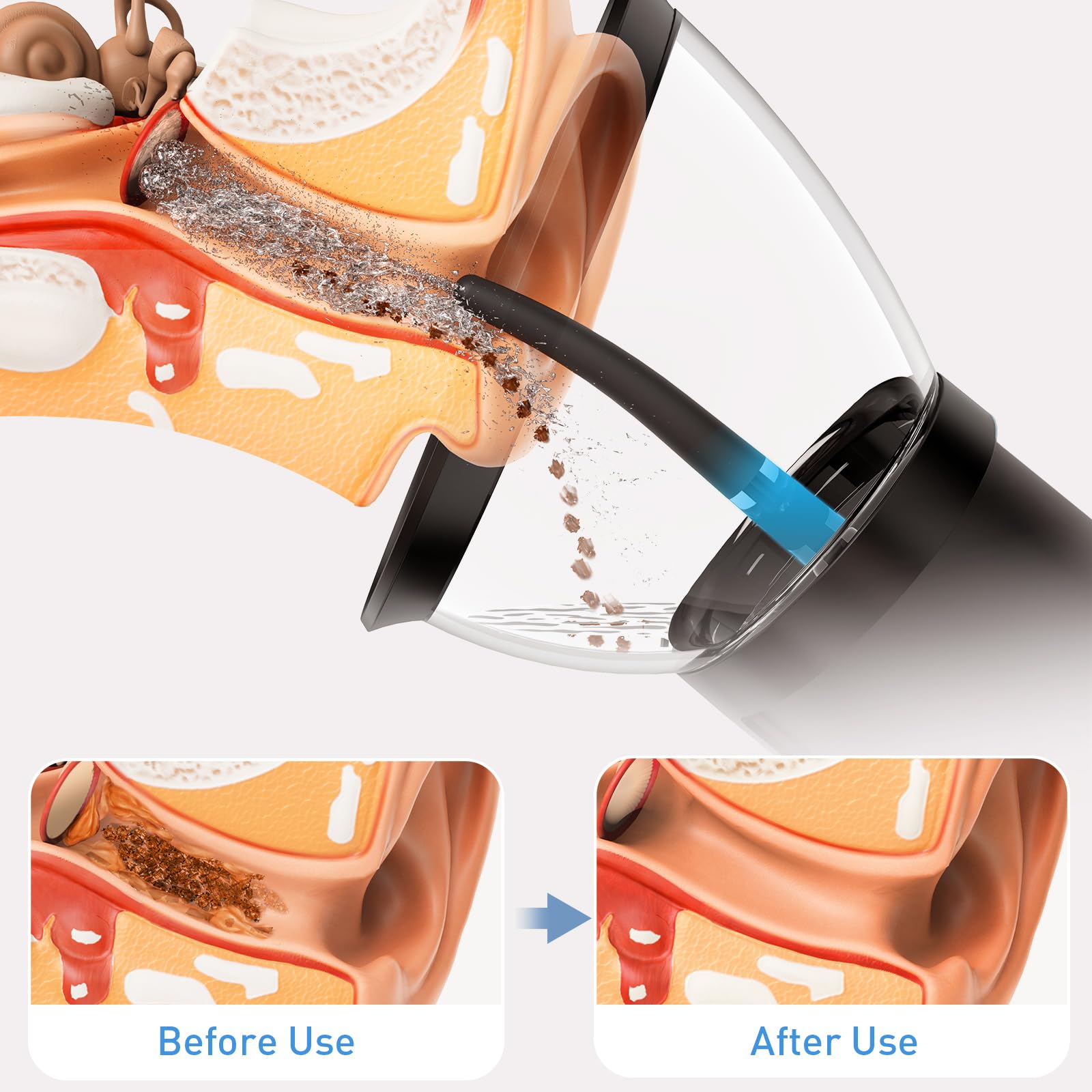 Yakbio Ear Wax Cleaner - Electric Ear Washer with 4 Pressure Modes, Retractable & Waterproof