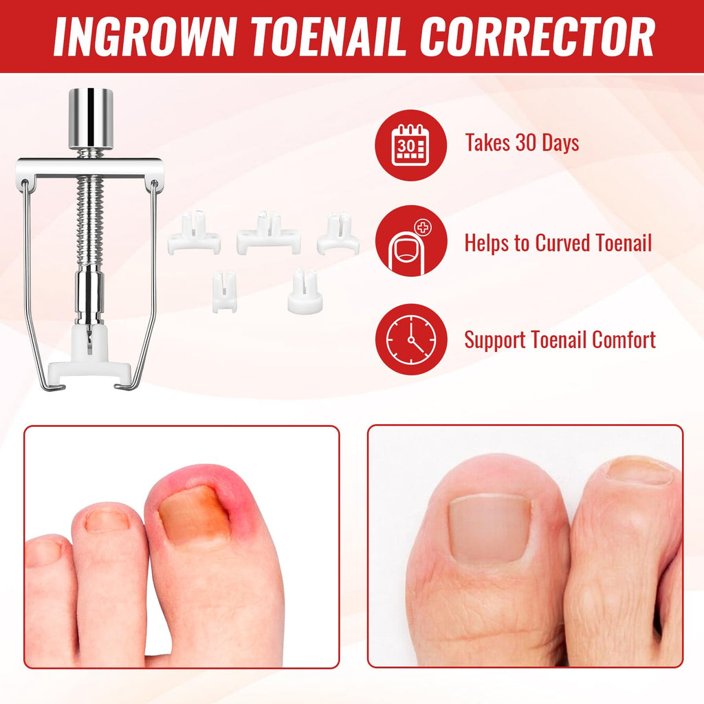 YEQOIZ Ingrown Toenail Removal Kit — All-In-One Home Care Tools