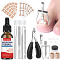 YEQOIZ Ingrown Toenail Removal Kit — All-In-One Home Care Tools
