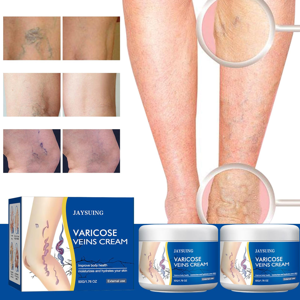 yetary Varicose Veins Cream for Legs – 2-Pack, Gentle Hydration & Care