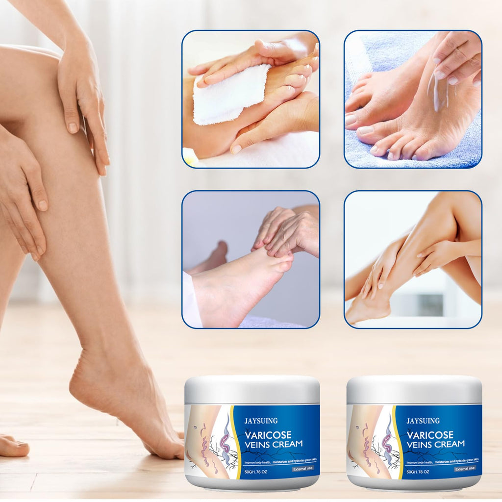 yetary Varicose Veins Cream for Legs – 2-Pack, Gentle Hydration & Care