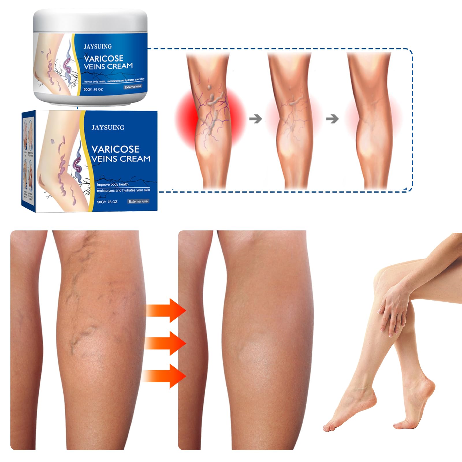 yetary Varicose Veins Cream for Legs – 2-Pack, Gentle Hydration & Care