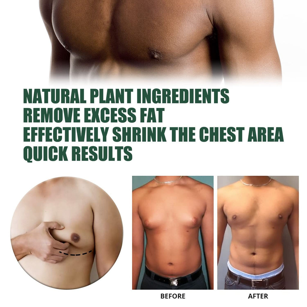 YG LianKai 2pcs Gynecomastia Tightening Ginger Cream – Chest Firming Massage Cream 30ml Each