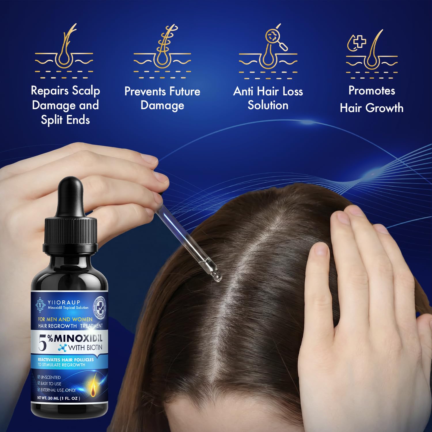 YIIORAUP 5% Minoxidil Hair Growth Solution – Extra Strength Topical for Men & Women (Biotin) – 2-Pack