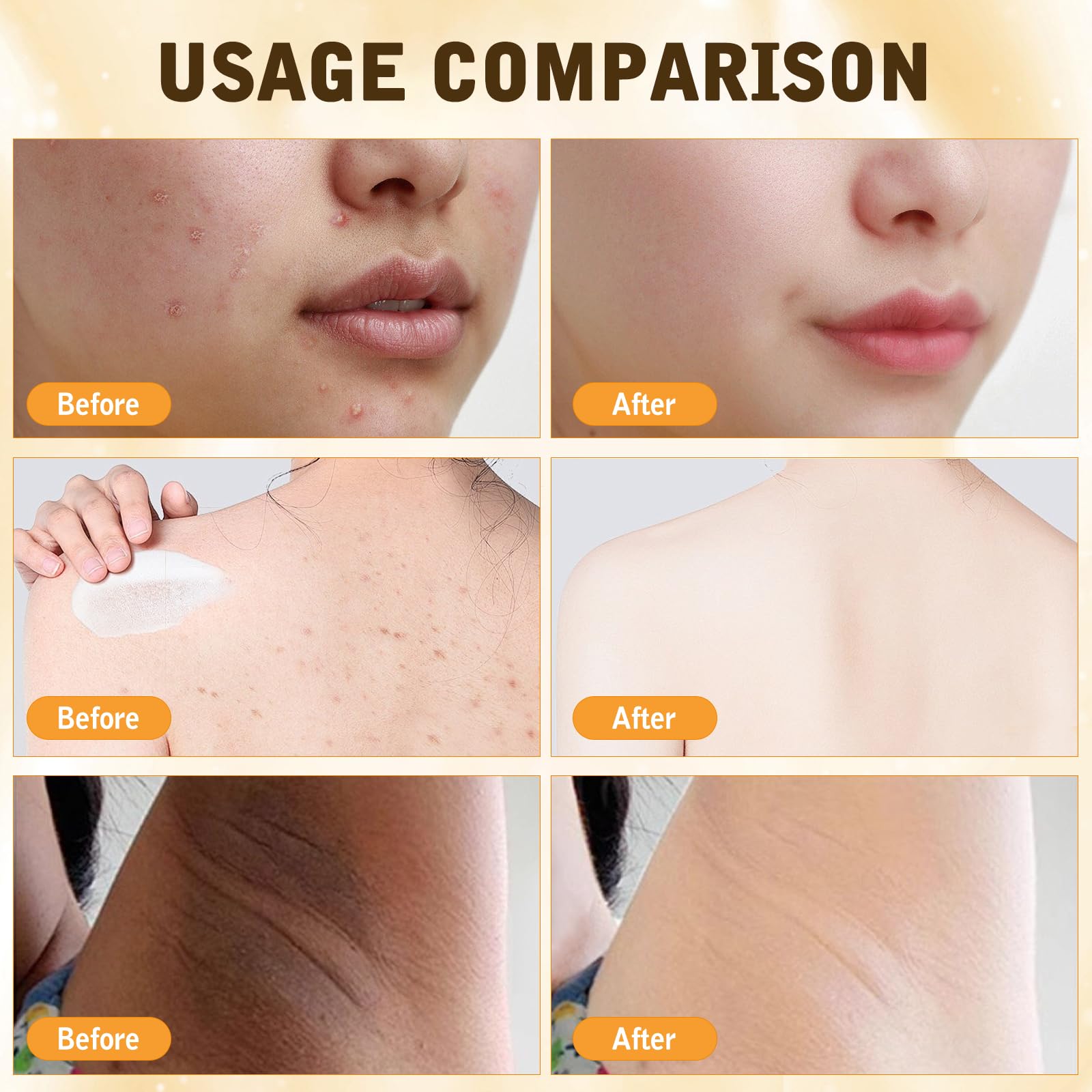 2PCS Bee Venom Comprehensive Cream by YIVANNUO – Deep Skin Moisturizer