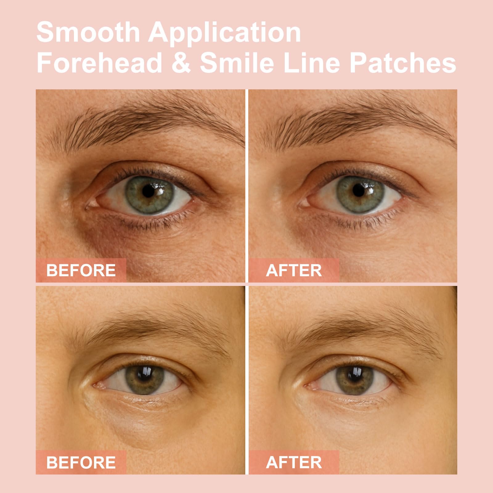 YLOTRE Novalift Micro Eye Patches – Deep Hydration for Puffy Eyes, Dark Circles & Fine Lines