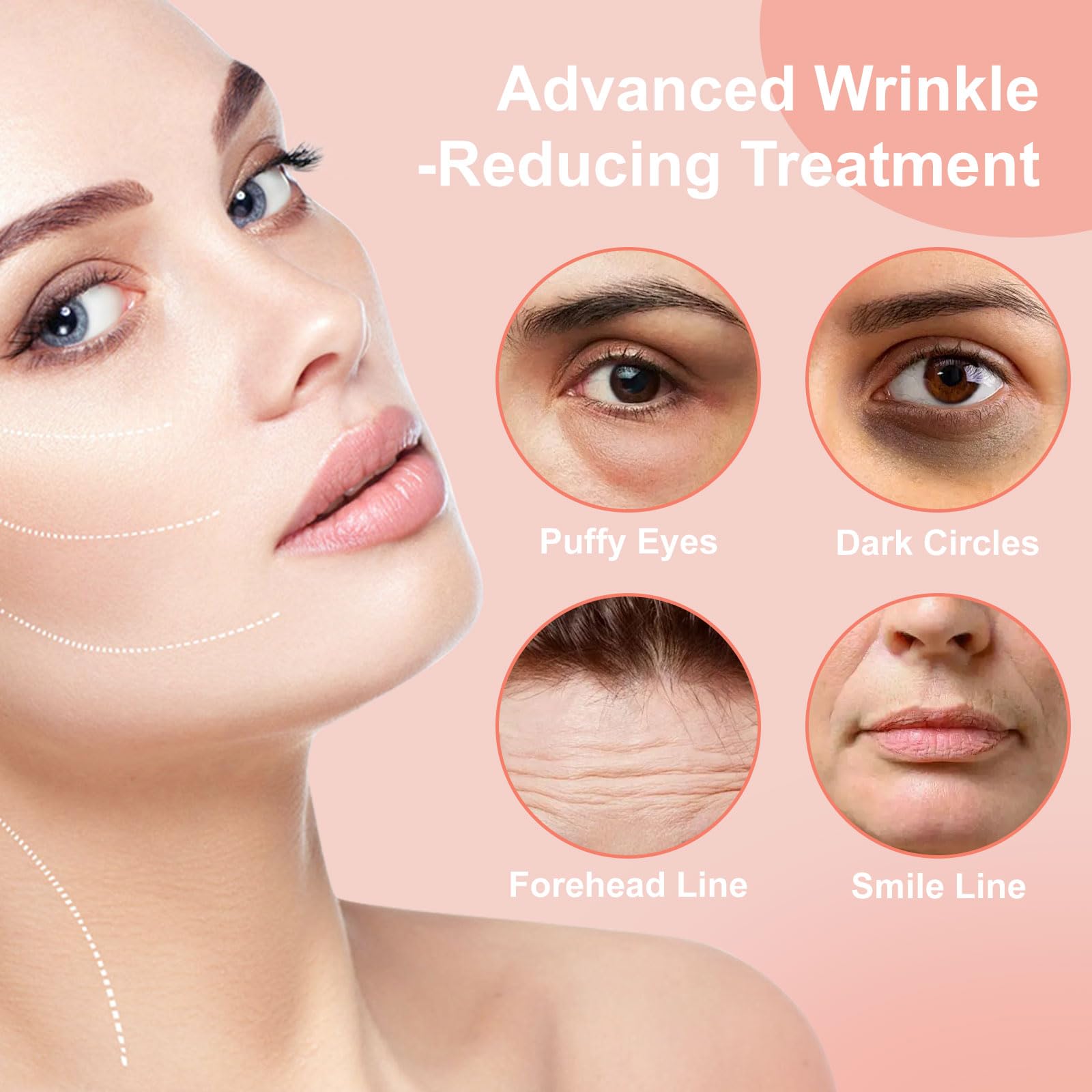 YLOTRE Novalift Micro Eye Patches – Deep Hydration for Puffy Eyes, Dark Circles & Fine Lines