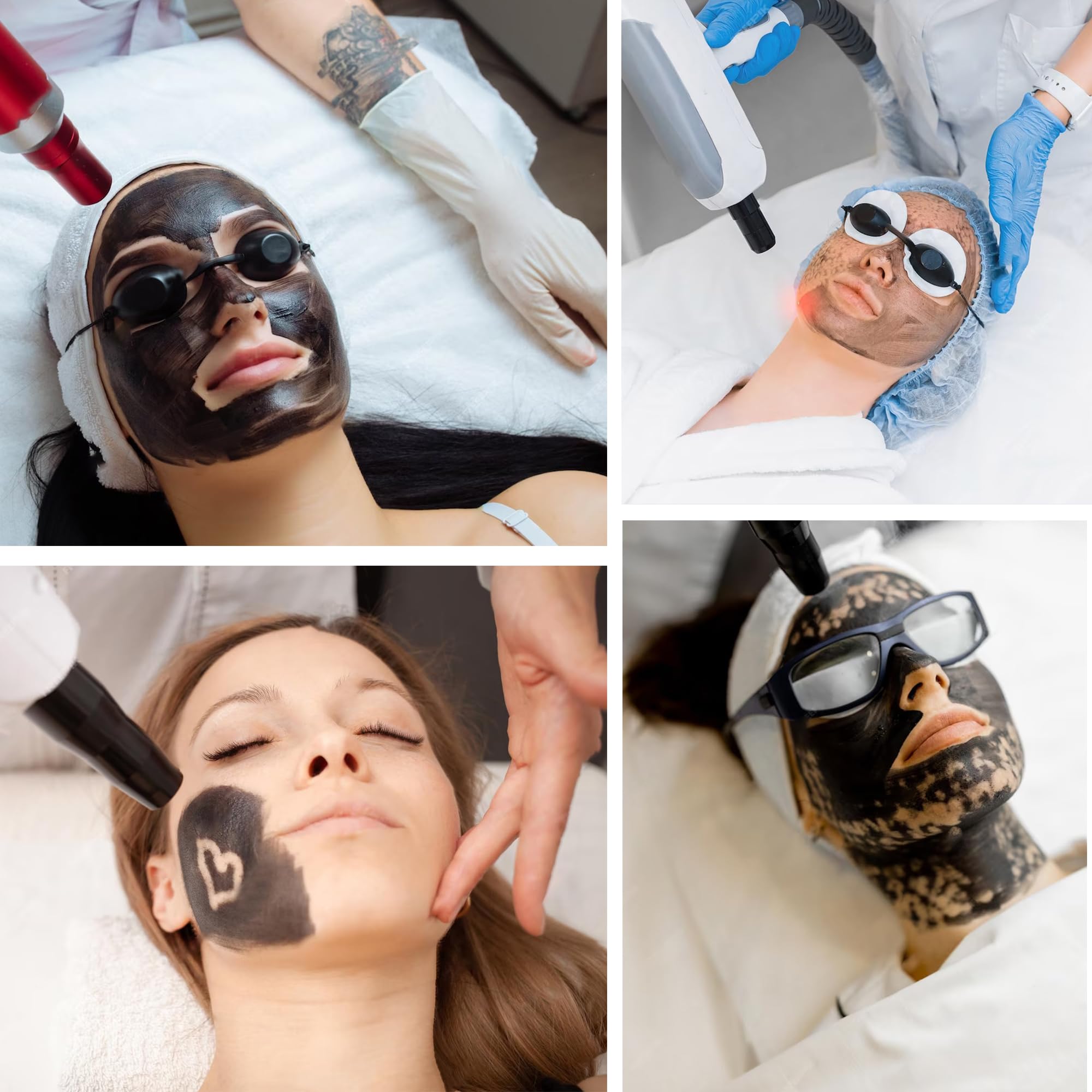 YMEYFAN Carbon Peeling Gel for Laser Hair Removal – Deep Cleansing & Pore Refinement (80ml)