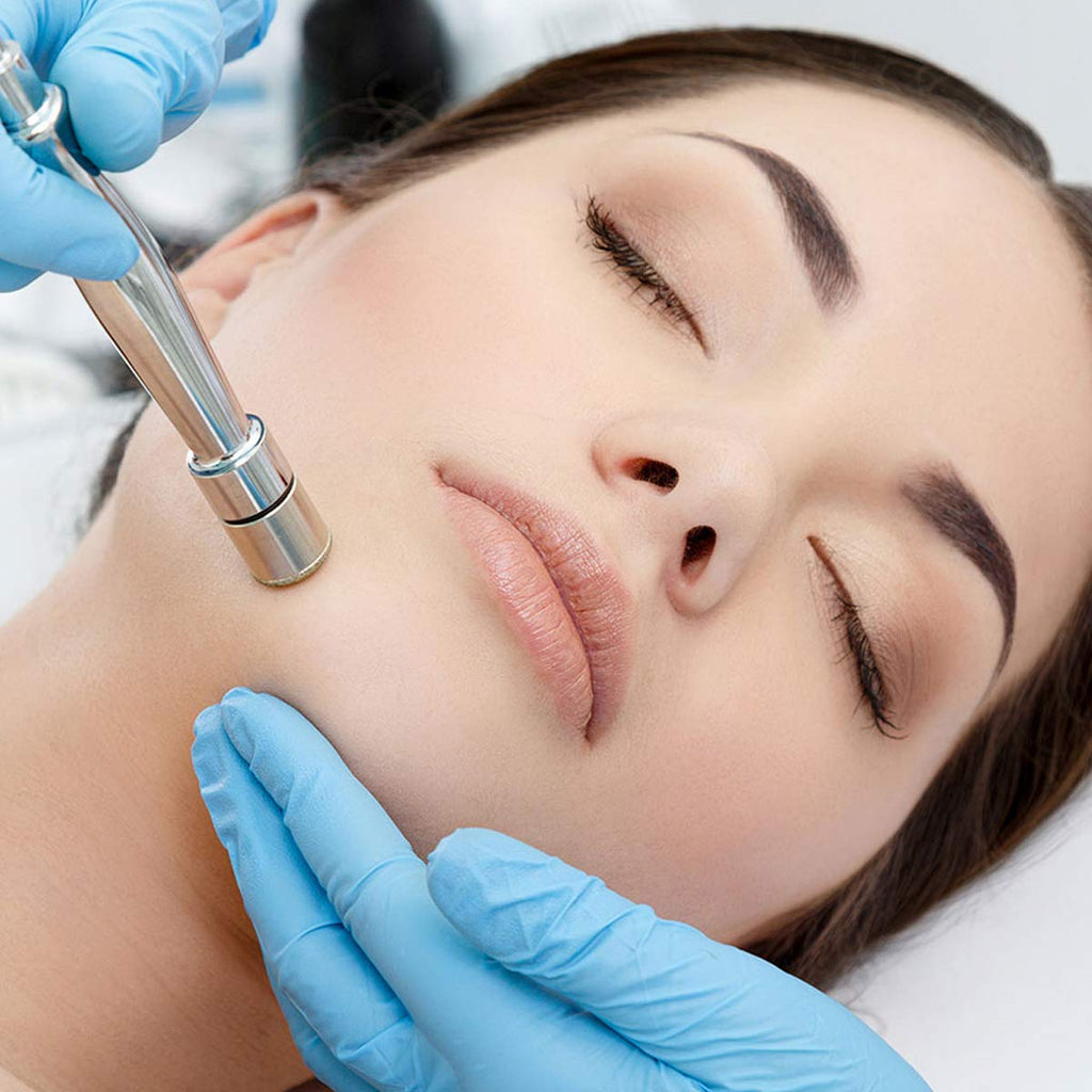 Yofuly Diamond Microdermabrasion Machine — 65-68 cmHg Suction for Home Use