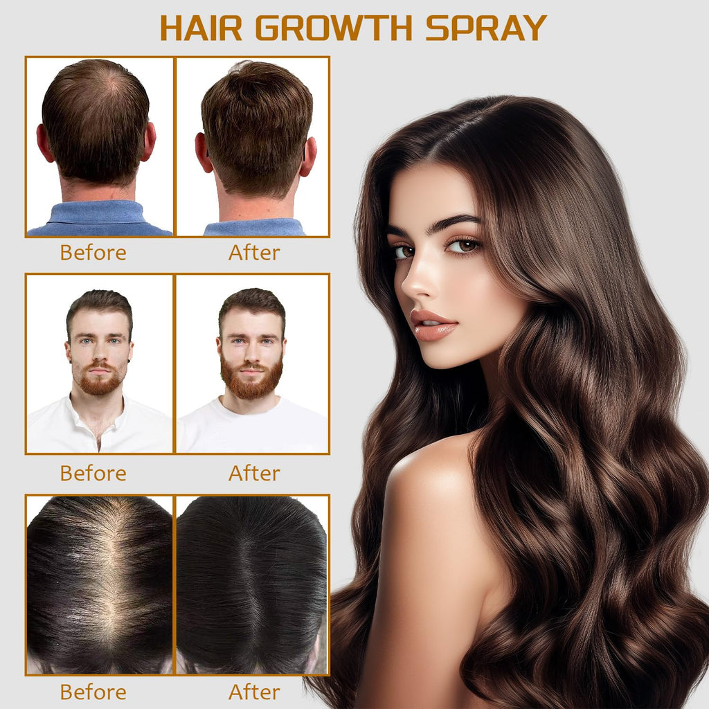 YOUNGYOUNGLOVE 5% Minoxidil Spray with Biotin – Hair Growth for Men & Women (3.38 oz)