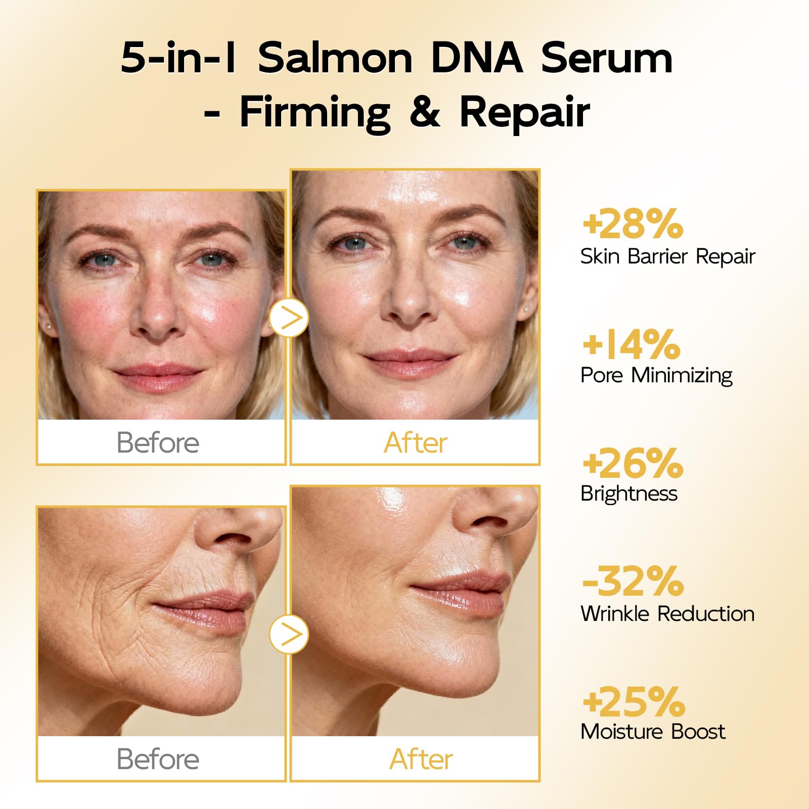 YouthVibe 0.5% PDRN Serum for Face – Anti‑Aging Salmon DNA Serum with HA, Niacinamide & Squalane, 30ml