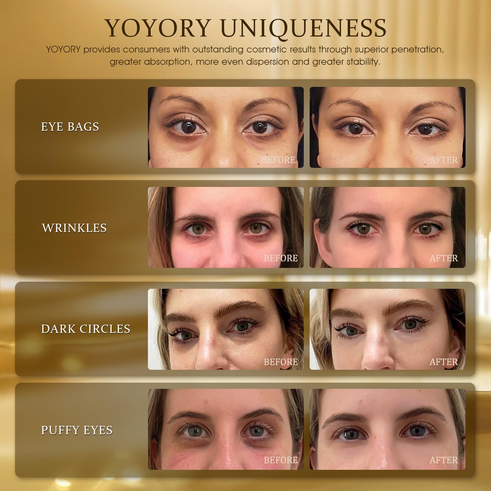 YOYORY 24K Gold Eye Patch Masks – 60 Pcs Hydration with Caffeine & Collagen for Dark Circles & Puffiness