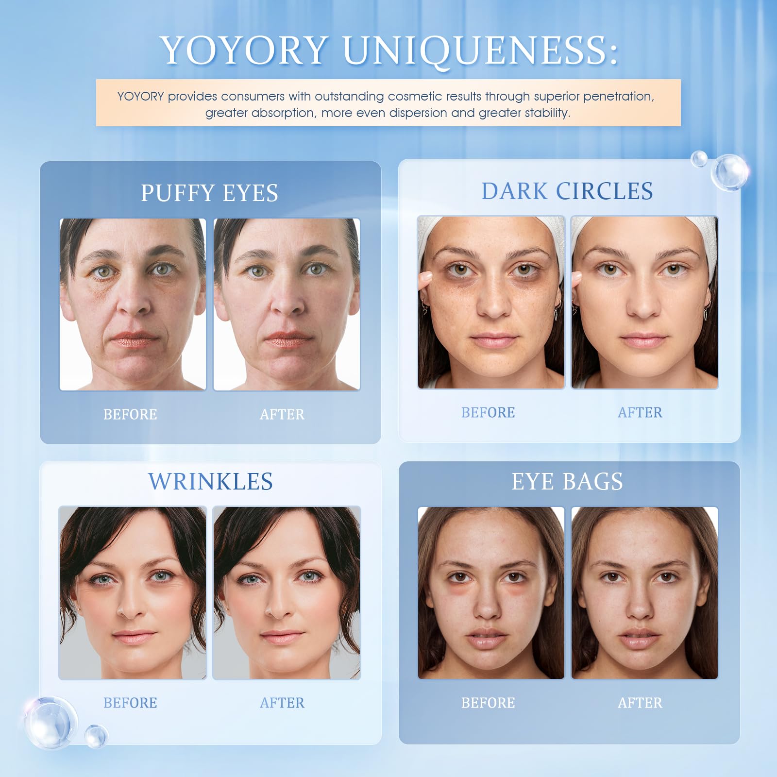 YOYORY Under Eye Patches Masks – Hydrating Hydrogel with Hyaluronic Acid & Peptides