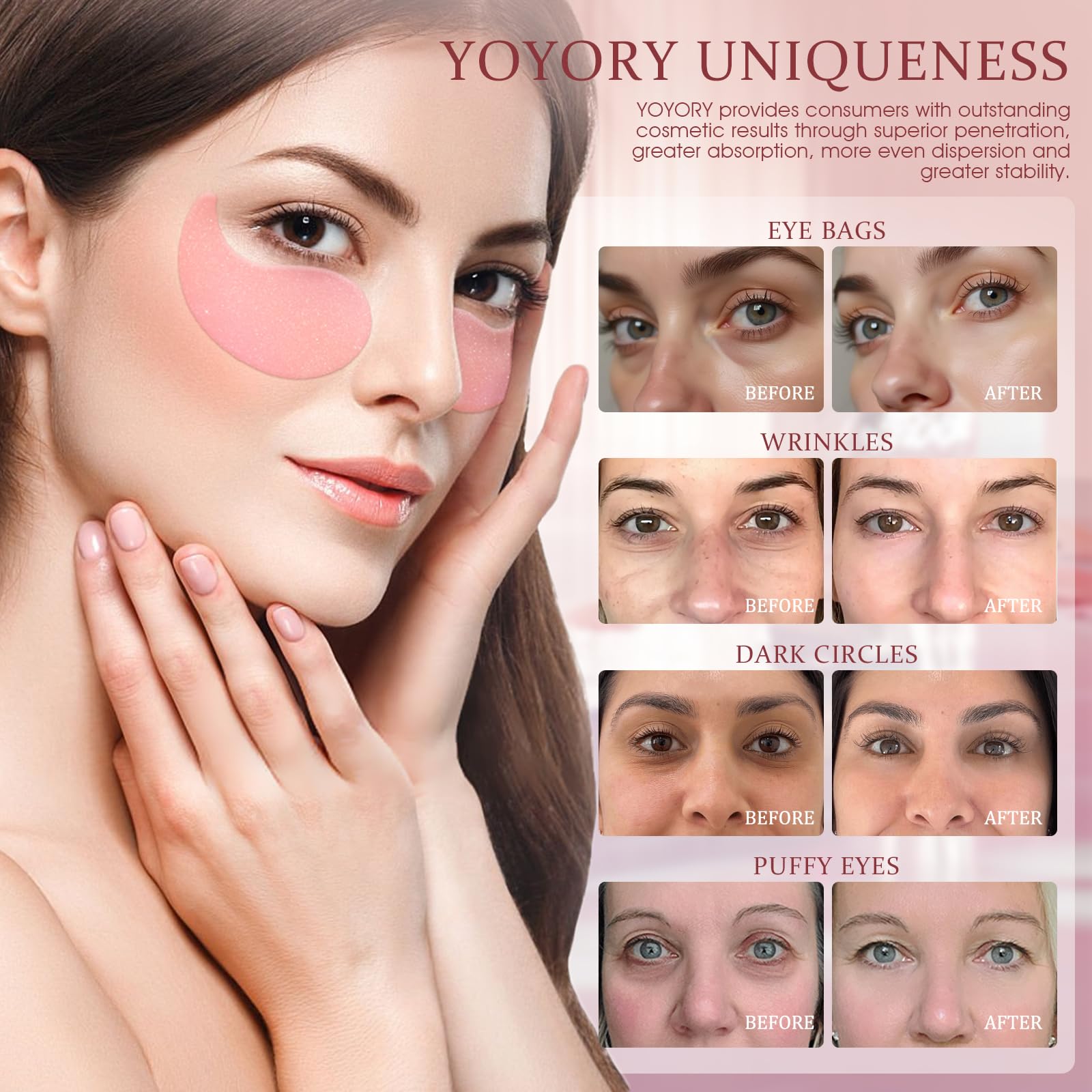YOYORY Under Eye Patches – Collagen & Hyaluronic Acid for Dark Circles, Puffiness, Fine Lines (60 Pcs, Pink)