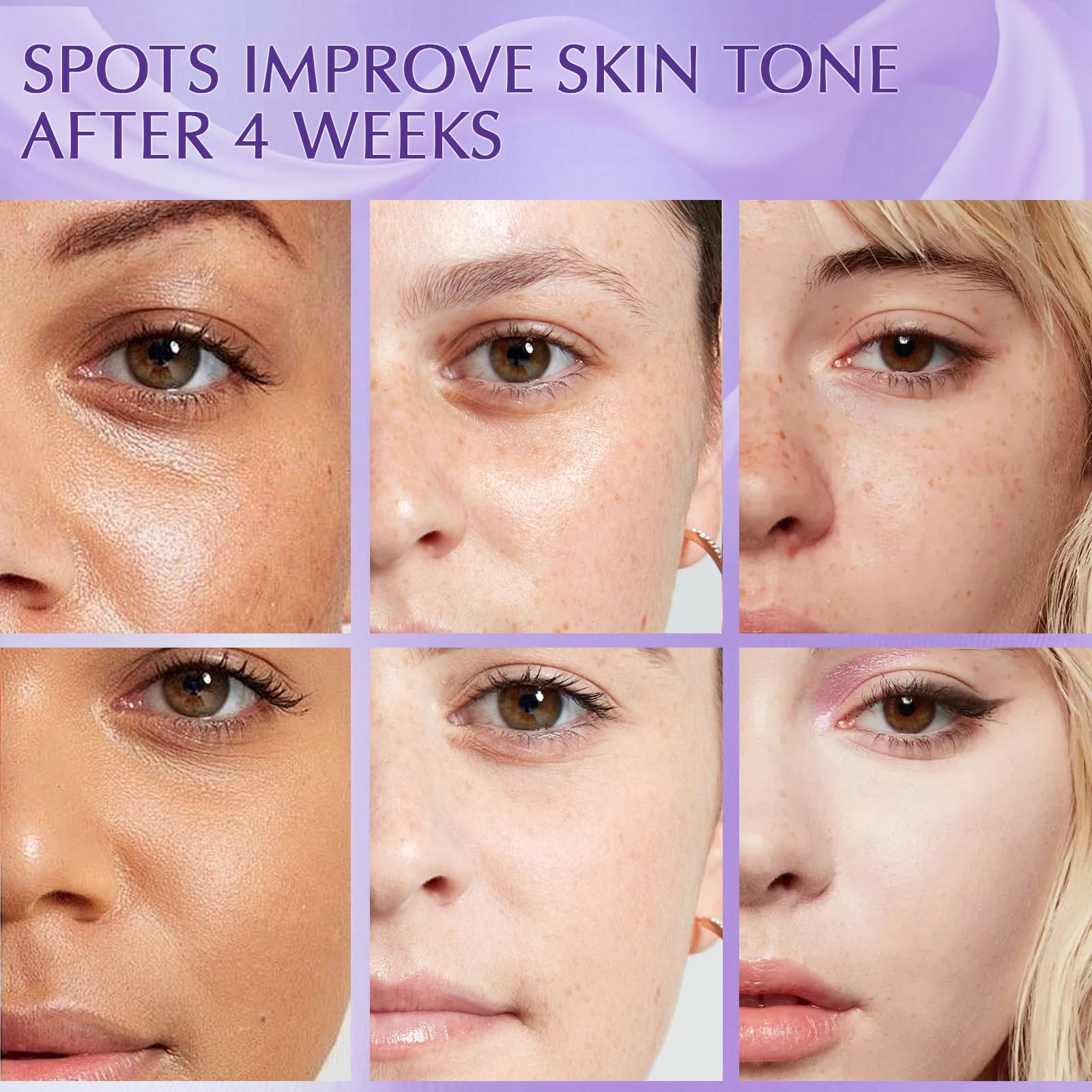 YRNVK Dark Spot Remover – Rapid Tone Repair Retinol Cream with Vitamin C