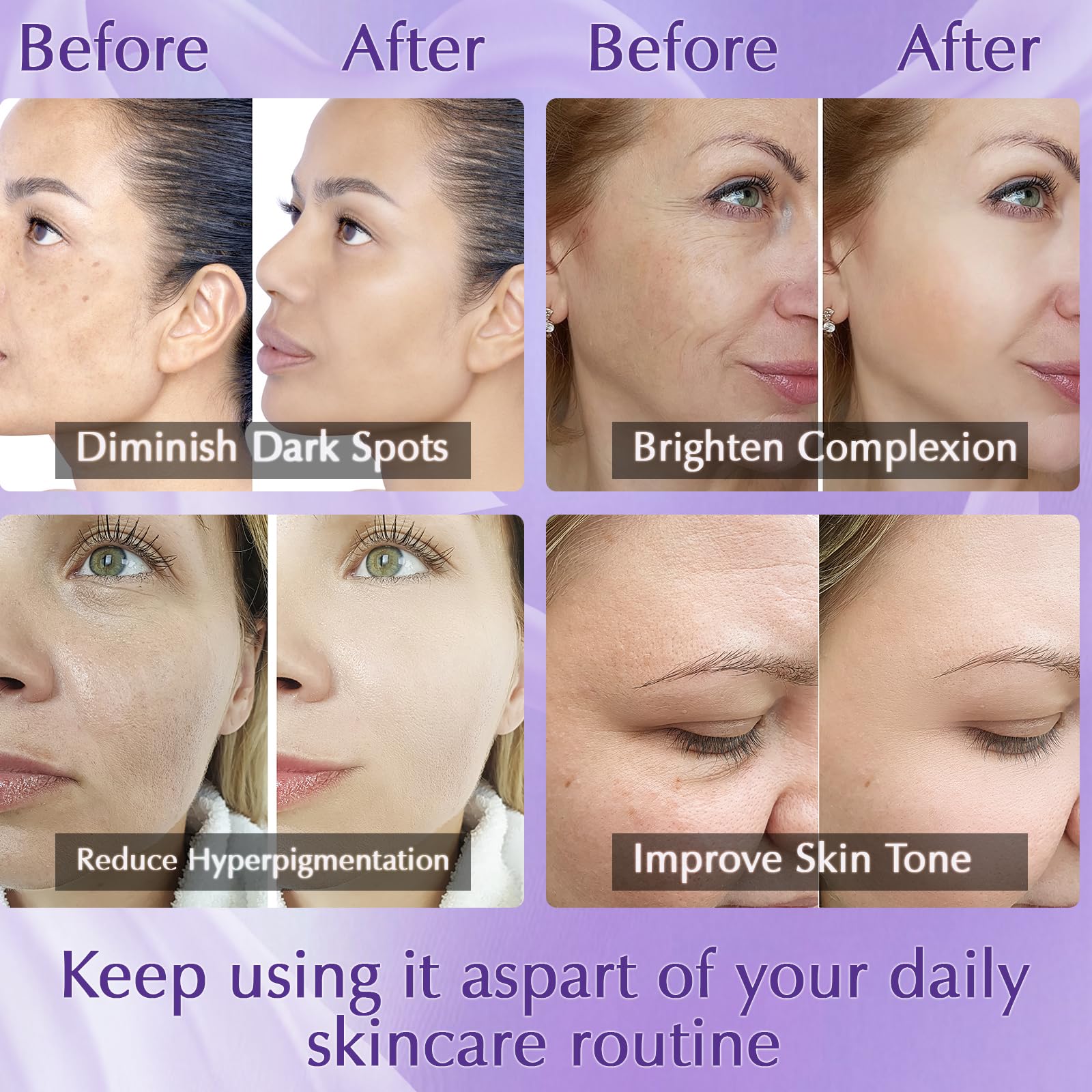 YRNVK Dark Spot Remover – Rapid Tone Repair Retinol Cream with Vitamin C