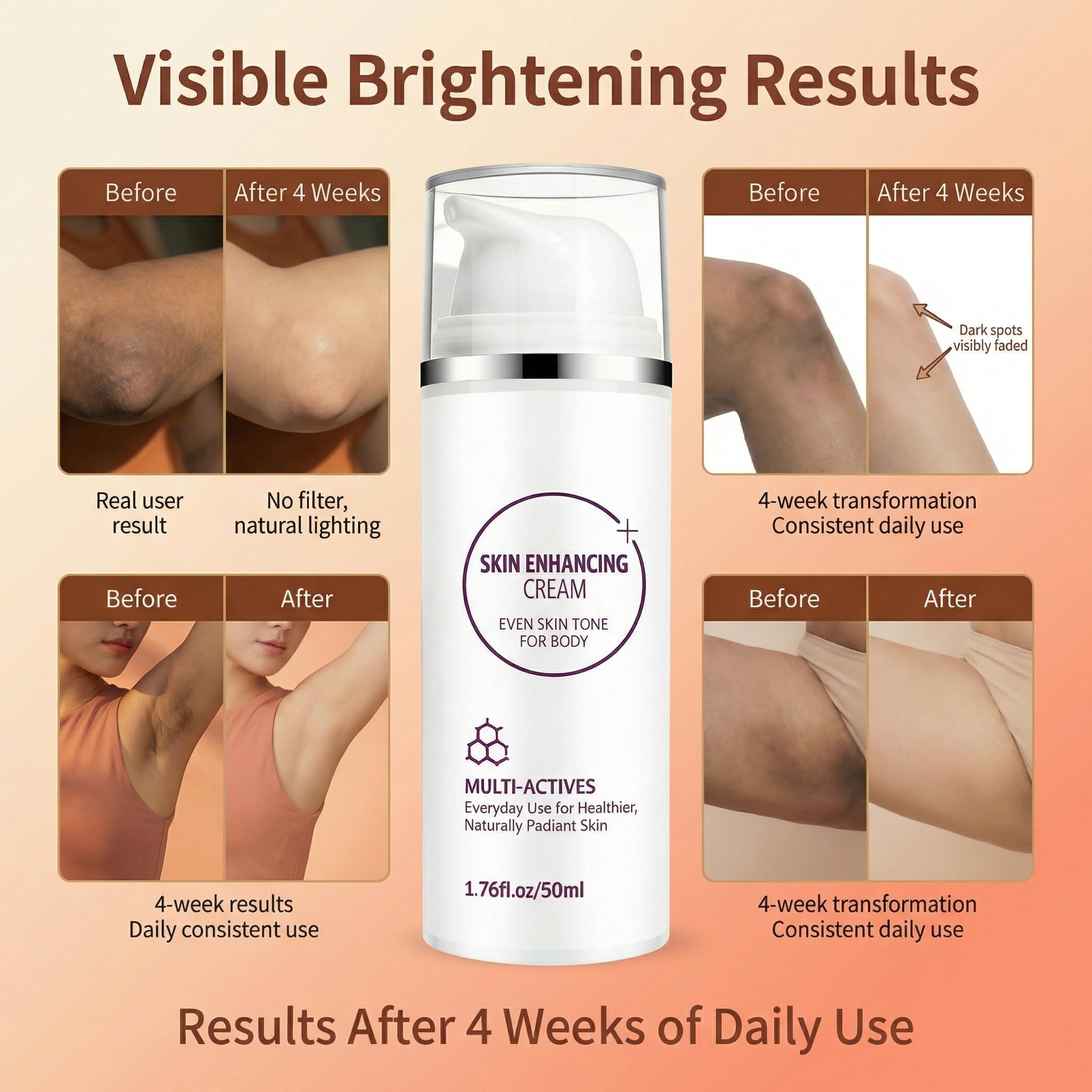 YTDB Dark Spot Remover for Body | Lightweight, Fast-Absorbing Cream (1.76 Fl Oz)