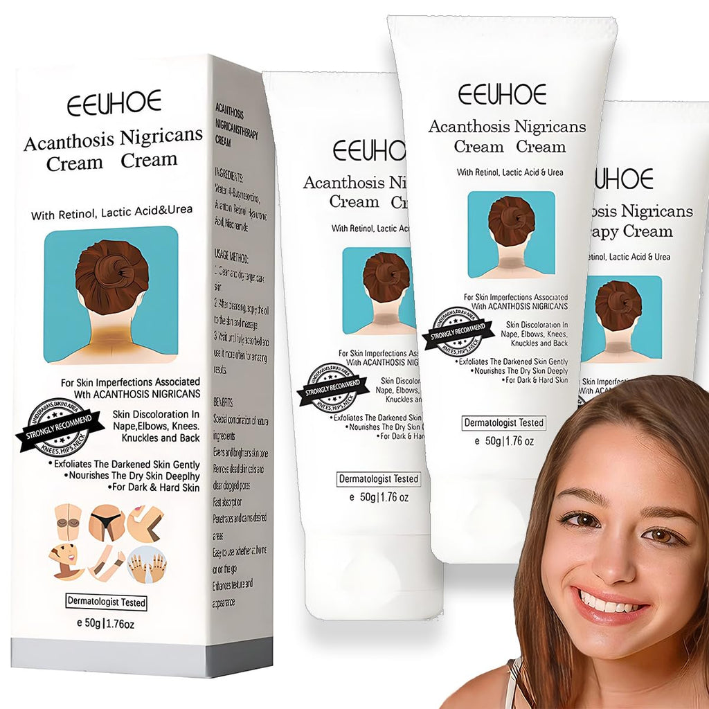 Yuehao Spot Remover for Body – Underarm & Neck (Acanthosis 3Box)