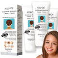 Yuehao Spot Remover for Body – Underarm & Neck (Acanthosis 3Box)