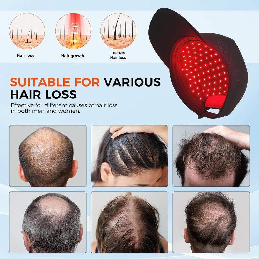 Yuxian Red Light Hair Growth Cap – Portable 660nm LED Hair Care Cap