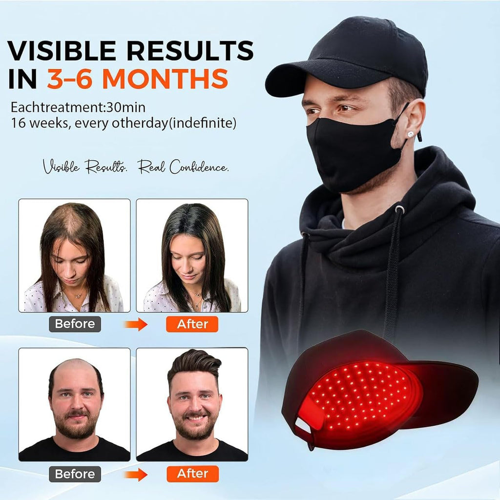 Yuxian Red Light Hair Growth Cap – Portable 660nm LED Hair Care Cap