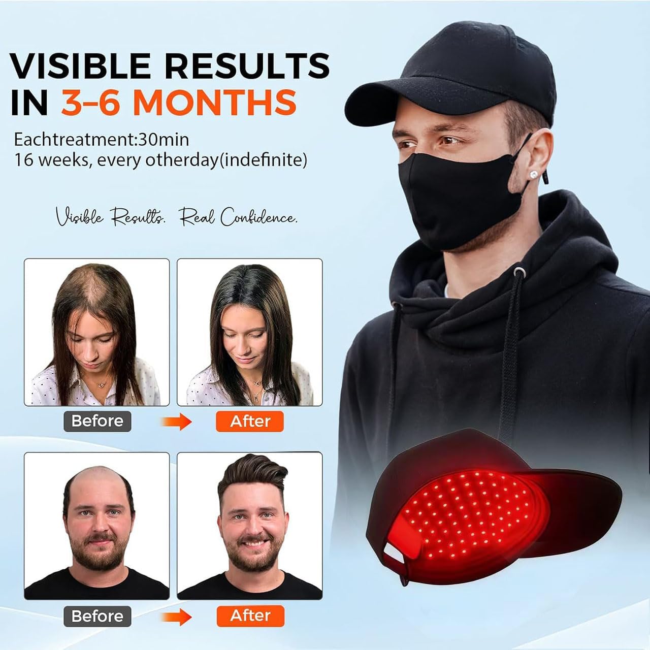 Yuxian Red Light Hair Growth Cap – Portable 660nm LED Hair Care Cap