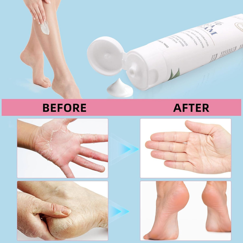 Zegrox Urea Cream 40% — Intensive Foot & Hand Moisturizer (3 x 1.75 oz)