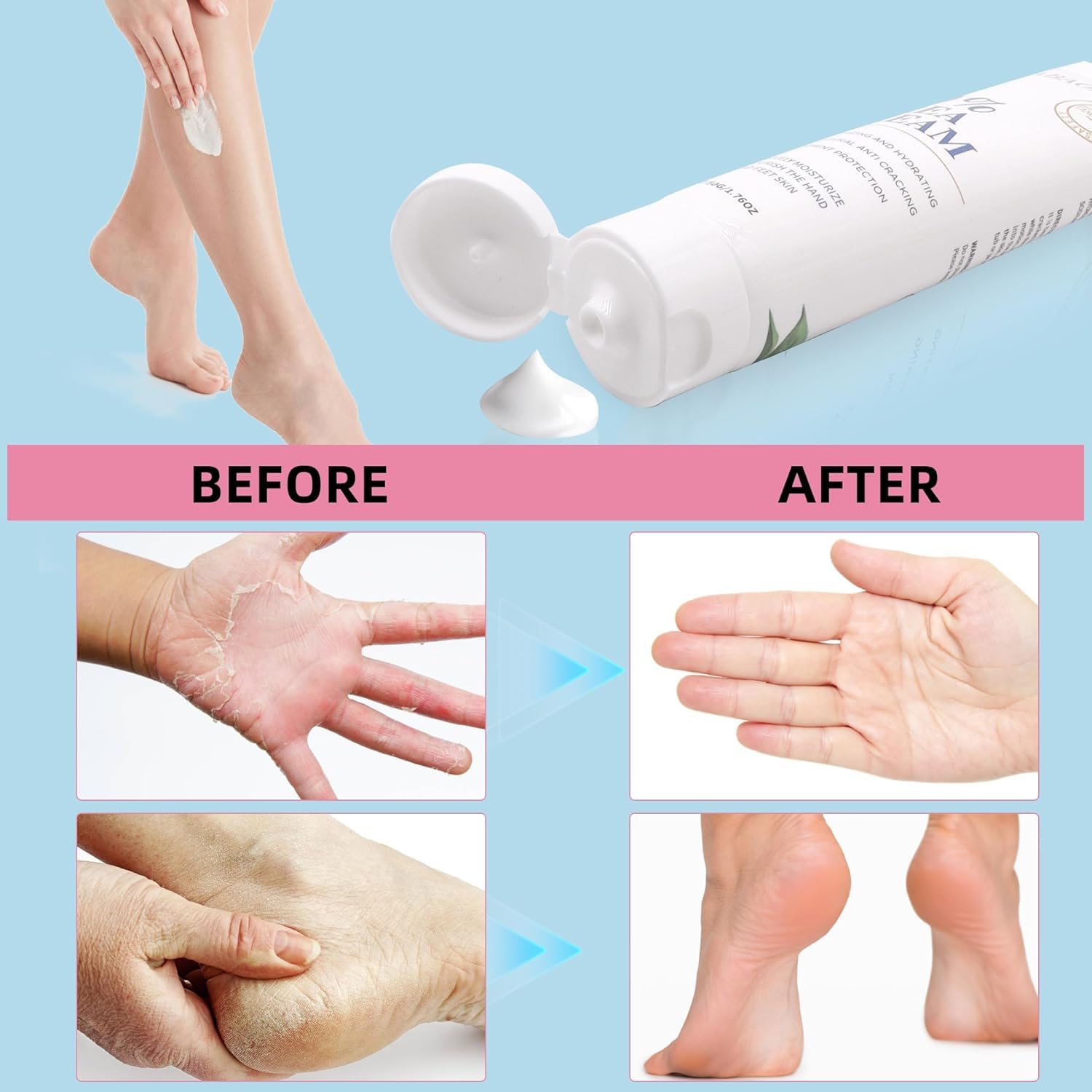 Zegrox Urea Cream 40% — Intensive Foot & Hand Moisturizer (3 x 1.75 oz)