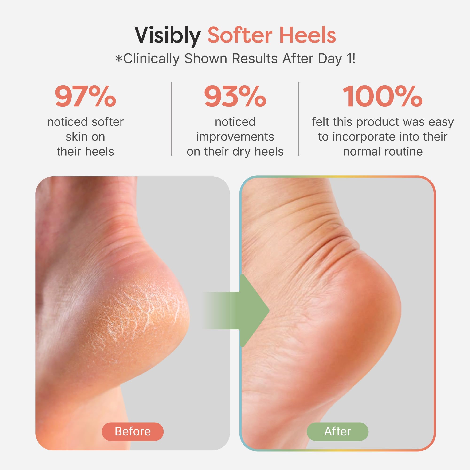ZenToes Moisturizing Socks for Cracked Heels – Vitamin E, Olive Oil & Jojoba Oil