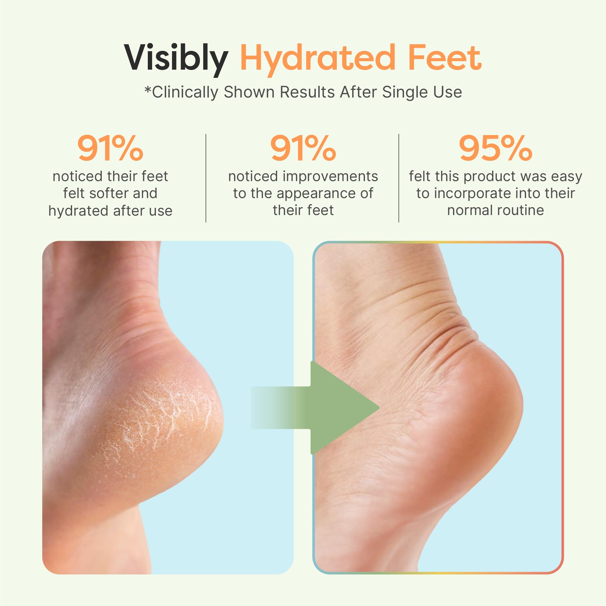 ZenToes Moisturizing Socks – Overnight Heel Treatment with Vitamin E, Olive Oil & Jojoba Oils