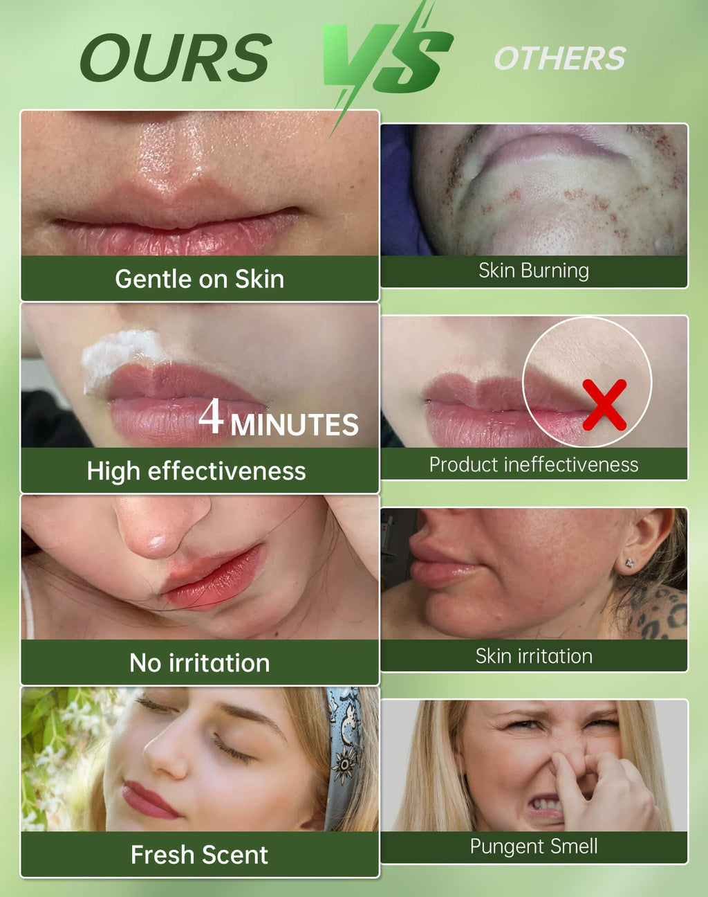 Zeponyx Painless Facial Hair Removal Cream for Women – Sensitive Skin 2-in-1 Kit (4-Minute, 7-Day Smooth) | Upper Lip & Chin