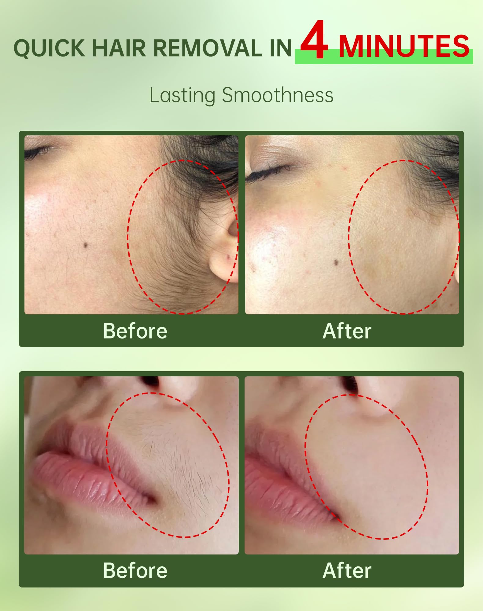 Zeponyx Painless Facial Hair Removal Cream for Women – Sensitive Skin 2-in-1 Kit (4-Minute, 7-Day Smooth) | Upper Lip & Chin