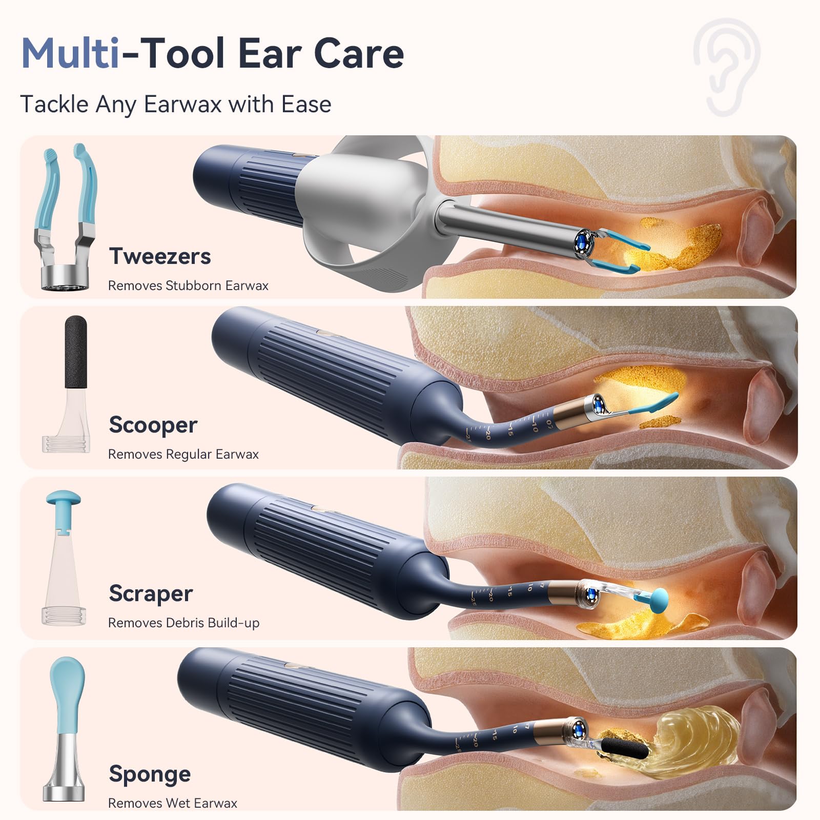 ZERONDER Ear Cleaner with Camera — 1080p Visual Ear Wax Removal Tool