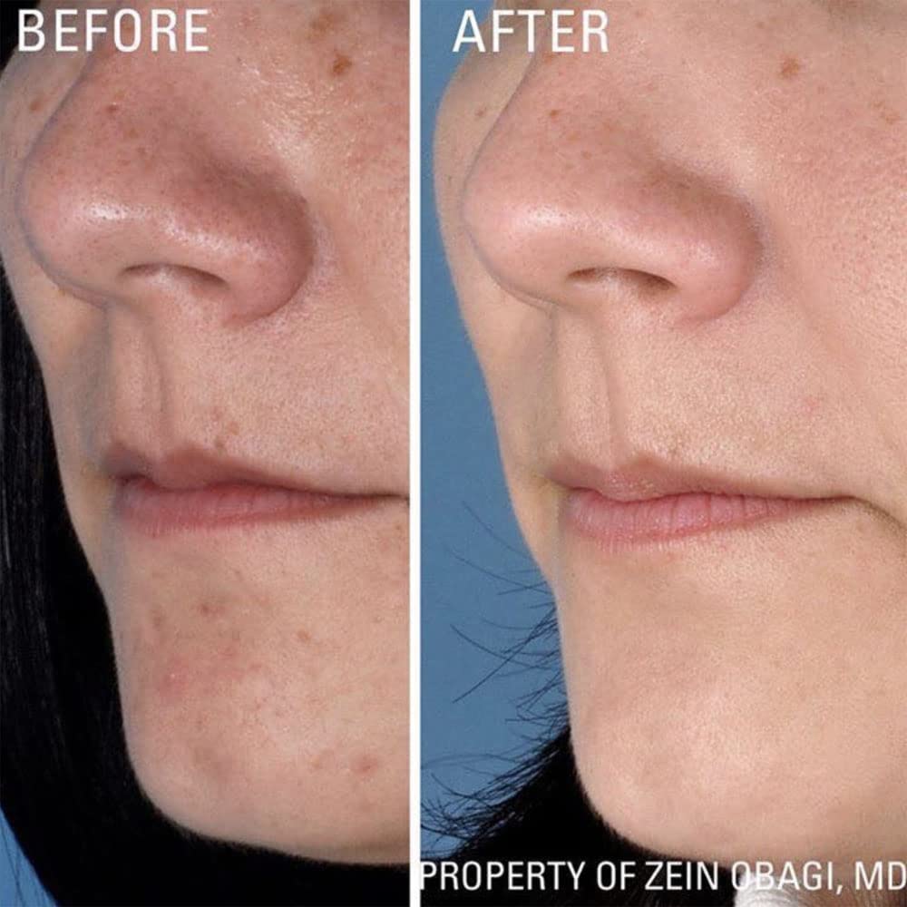 ZO SKIN HEALTH Instant Pore Refiner – 29 g / 1 oz | Matte Finish & Refined Pores