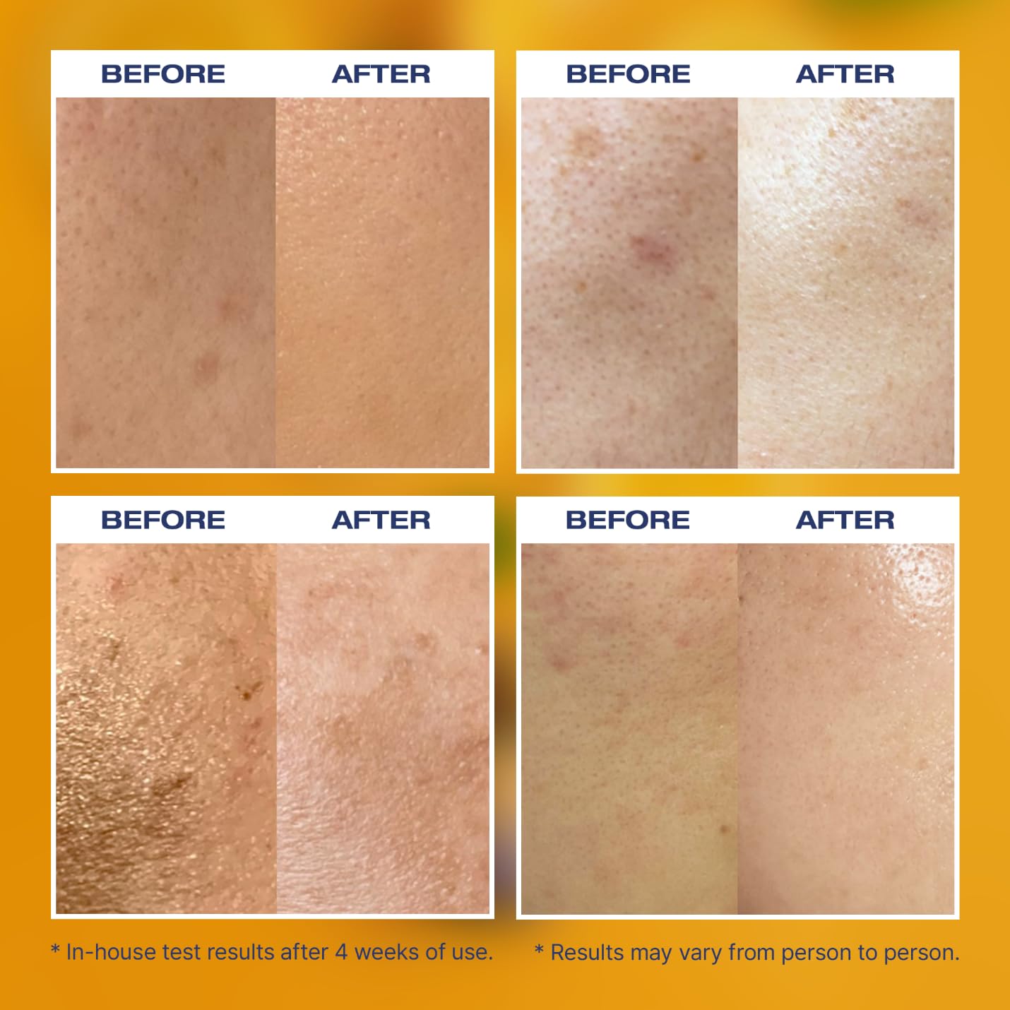 ZOLOPIX MINTAVI20 20% Vitamin C Serum — Brightening & Even Tone (26ml)