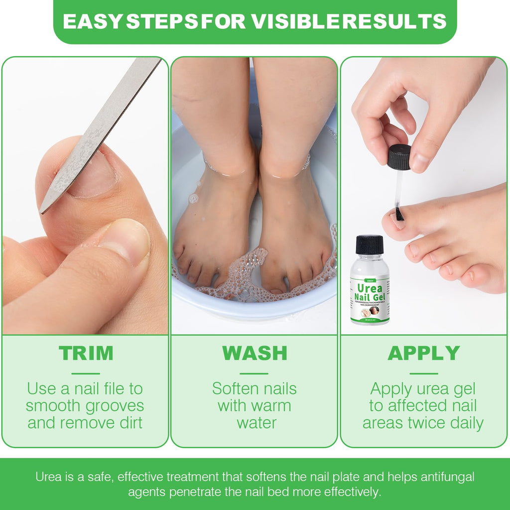 ZOXY Urea Nail Gel 40% – Softens Thick Nails & Discoloration | Fast-Absorbing Nail Restoration
