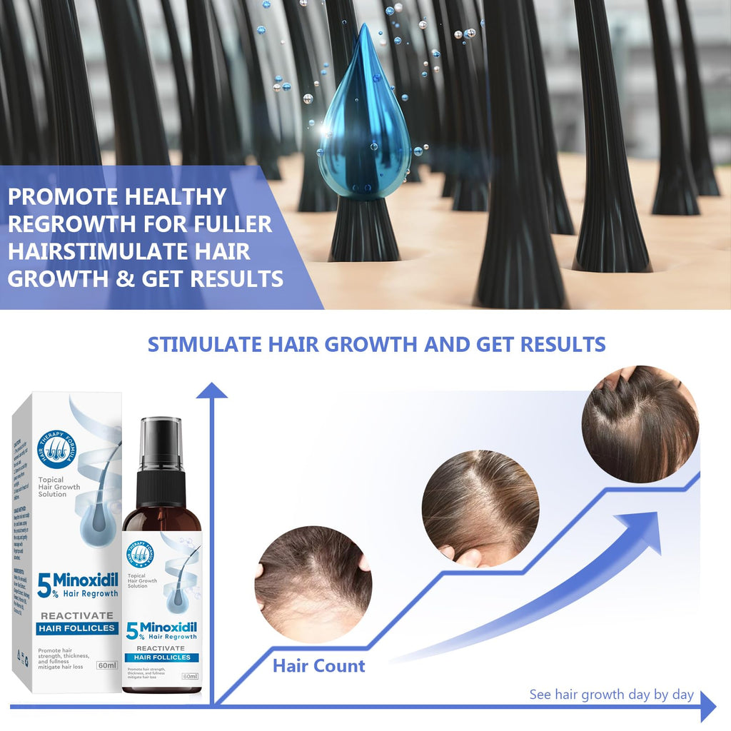 ZVBZVB Minoxidil 5% Hair Growth Spray – Thicker Hair & Beard, 60ml