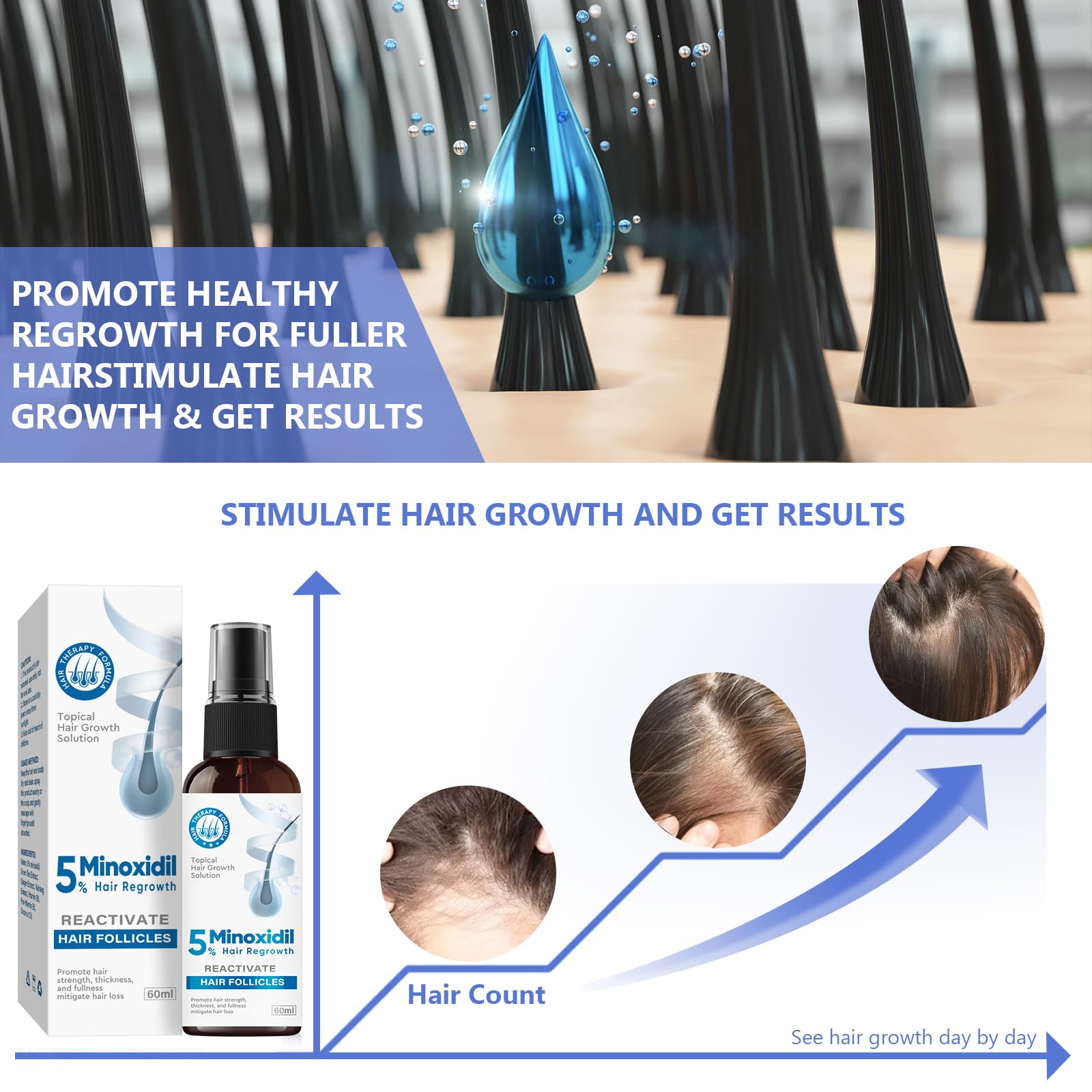 ZVBZVB Minoxidil 5% Hair Growth Spray – Thicker Hair & Beard, 60ml