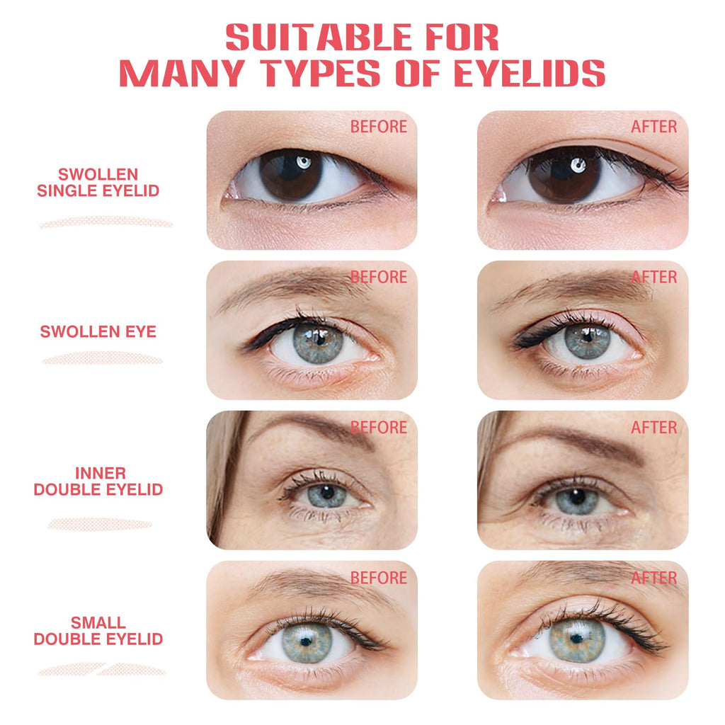 ZYQTQZ Eyelid Tape – Ultra-Thin Invisible Double Eyelid Strips, Waterproof & All-Day Hold (632 Pcs)