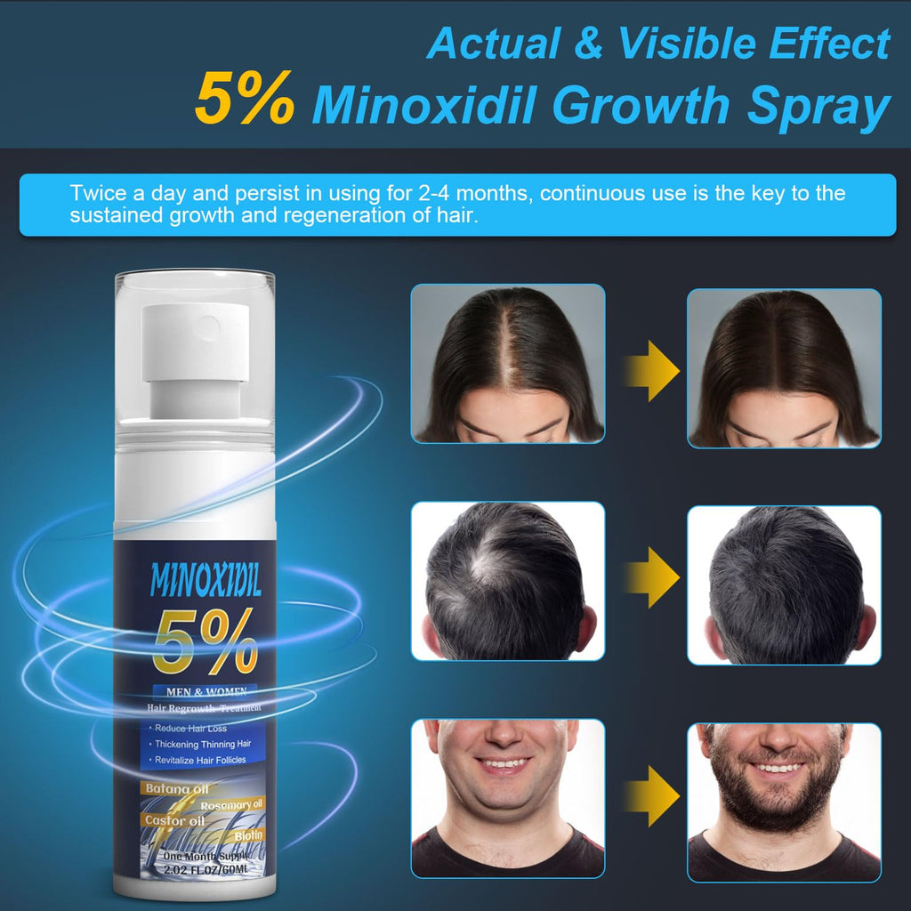 ZYXN 5% Minoxidil Hair Growth Serum for Men & Women with Biotin, Rosemary & Batana – 2.02 fl oz